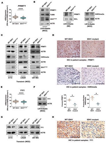 Figure 1. Expressions of PRMT1, H4R3me2a and YY1 in WT IDH1 and IDH1R132H gliomas. (A) TCGA dataset analysis depicts PRMT1 mRNA expression in IDH1R132H and WT IDH1 glioma patients. Data from n = 270 WT IDH1 and 365 IDH1R132H patients have been used for analysis. Whiskers represent 10–90 percentile. ****P < 0.0001 (two-tailed Student’s t-test). (B) Immunoblots show reduced PRMT1 and histone mark H4R3me2a levels in IDH1R132H cells. (C) Representative western blots show diminished PRMT1 and H4R3me2a levels in A172, LN229 and U87-MG cells transiently expressing IDH1R132H compared to the wild-type counterparts. (D) Representative images of immunohistochemical staining shows reduced PRMT1 and H4R3me2a expression in IDH1 mutants as compared to WT IDH1 glioma patients. Scale bar: 100 µm. n = 3 WT DH1 and n = 3 IDH1 mutant patients. Data in graphs are presented as mean ± s.e.m. *P < 0.05 (two-tailed Student’s t-test). (E) TCGA dataset analysis depicting YY1 mRNA expression in WT IDH1 and IDH1R132H glioma patients. Data from n = 270 WT IDH1 and 365 IDH1R132H patients from TCGA have been used for analysis. Whiskers represent 10–90 percentile. ****P < 0.0001 (two-tailed Student’s t-test). (F) Representative western blot shows reduced YY1 levels in IDH1R132H cells. (G) Immunoblots show diminished YY1 levels in IDH1R132H-overexpressing A172, LN229 and U87-MG cells. The image of loading control used for YY1 is the same as that used for PRMT1 (Figure 1C) in case of LN229 cells. (H) Immunohistochemistry evaluations show reduced expression of YY1 in IDH1 mutants as compared to WT IDH1 glioma patients. Scale bar: 100 µm. n = 3 WT IDH1 and n = 3 IDH1 mutant patients. Blots are representative of n = 3 biological replicates. WCE, whole cell extract; NE, Nuclear extract.