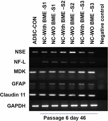 Figure 6. Semi-quantitative gene expression profiling by RT-PCR of ADSC-derived neural-lineage cells for three neural-induced samples from patients S1-3 at d 25 after induction with two different treatments: NIM with β-ME (WBME) and without β-ME (W/O BME). Untreated ADSCs used as control.