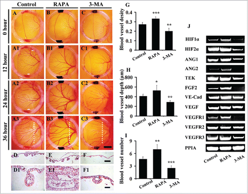 Figure 3. The 3-MA exposure reduces and RAPA exposure promotes angiogenesis in chick YSM. (A-C) The representive images of leading edges of vessel plexuses within silicon rings at 0 hour from control (0.1% DMSO) (A), RAPA-treated (B) and 3-MA-treated (C) YSM respectively. (A1-C1, A2-C2, A3-C3) The representive images at 12-h, 24-h, 36-h incubation respectively. (D-F) The transverse sections at the levels indicated by white dotted lines in A3-C3 respectively. (D1-F1) The high magnification images from (D-F) respectively. (G-I) The bar charts showing the comparison of blood vessel densities, numbers, depths among control, RAPA-treated and 3-MA-treated groups. (J) The RT-PCR data showing the expressions of TEK, VE-Cad, HIF 2α, FGF2, VEGFA, VEGFR1, VEGFR2, VEGFR3, ANG1 and ANG2 in control (0.1% DMSO), RAPA-treated and 3-MA-treated YSM tissues. Abbreviation: VE-Cad, VE-cadherin. Scale bars = 2.5 mm in A-C, A1-C1, A2-C2, A3-C3; 200 µm in D-F and 100 µm in D1-F1.