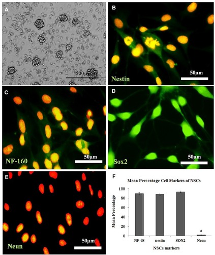 Figure 3 Cultured the Neural Stem Cell (NSC) derived from the Neurospheres (NS), immunostaining, and the percentage of immunoreactive cells to each neural marker. (A) Morphology of the NS (7 days), (B–E): Immunolabeling with the primary antibodies to nestin, NF-160, Sox2, and Neun, respectively, and counterstained with propidium iodide. (F) Histogram of the percentage of immunoreactive cells (NSC) to nestin, NF-160, Sox2, and Neun. aStatistically different from nestin, NF-160, Sox2.