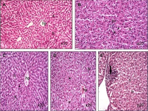 Figure 5 Photomicrograph of liver tissue sections of rats treated with Ni nanoparticles.Notes: (A) control (100X); (B–D) distorted architecture (indicated by the asterisk) of the liver sinusoids with 10 mg/kg Ni nanoparticles (200X); (E) lymphoctic and eosinophilic infiltrates at the periphery of the liver (dark arrow) with 20 mg/kg Ni nanoparticles (200X).Abbreviations: h, hepatocytes; hp, hepatic portal; Ni, nickel; s, sinusoids; hv, hepatic vein.