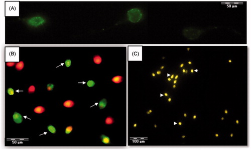 Figure 3. Fluorescence images of sperm stained for DNA methylation (A), DNA fragmentation (B), and protamine deficiency (C). DNA methylation was assessed by antibody against 5-methylcytosine. DNA fragmentation was assessed by TUNEL staining (spermatozoa with fragmented DNA stained green (TUNEL positive, shown with arrow), whereas TUNEL negative sperm appear as red due to propidium iodide staining of nuclei). Protamine deficiency was assessed by chromomycin A3 (CMA3) staining, spermatozoa with bright yellow staining were considered as protamine deficient or CMA3 positive (arrow head), while spermatozoa with dull yellow staining were considered as having a normal amount of protamine or CMA3-negative.