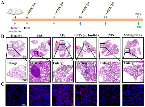 Figure 9 In vivo anti-pulmonary metastasis effect. (A) Schematic illustration of the schedule for drug treatment. (B) H&E analysis of the lung. Scale bars: 1mm, 200 μm. (C) Immunofluorescence assay of the α-SMA protein (red arrow). Scale bars:100 μm.