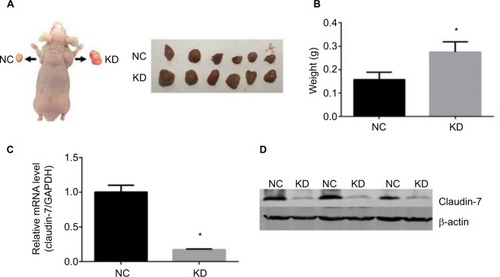 Figure 5 The growth of stable transfected cell lines HCT116NC and HCT116KD subcutaneously in nude mice.Notes: (A, B) Comparison of the quality of groups HCT116NC and HCT116KD of implanted tumors in nude mice. Compared with group HCT116NC, the ability of subcutaneous tumor formation in nude mice was enhanced in group HCT116KD. (C, D) The expression of claudin-7 in subcutaneous tumor tissue of nude mice which was transfected with stable transfected cell lines HCT116NC and HCT116KD. Compared with group HCT116NC, the expression levels of claudin-7 in mRNA and protein levels in group HCT116KD were significantly decreased.Abbreviations: NC, negative control; KD, knockdown.