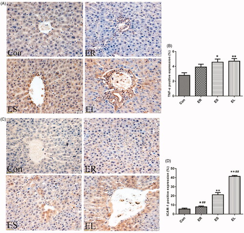 Figure 7. Expression of tumor necrosis factor-α (TNF-α) and intercellular cell adhesion molecule-1 (ICAM-1) in the liver tissues (400×). The rats were treated with the ethanol extracts of different parts of C. serratus (ER: 4.14 g/kg/day, ES: 3.20 g/kg/day and EL: 1.16 g/kg/day) for 14 days. (A) Immunohistochemistry results of TNF-α. The column chart represented the positive expression rate of TNF-α (B). (C) Immunohistochemistry results of ICAM-1. The column chart represented the positive expression rate of ICAM-1 (D). The positive expression of TNF-α in the ER group was not significantly different from that in the Con group, whereas its expression was significantly increased in the ES and EL groups. The expression of ICAM-1 in the treatment groups was significantly increased compared with that in the Con group. Data were presented as mean ± SD (n = 6). *p < 0.05, **p < 0.01 vs. the Con group.