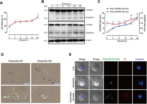 Figure 3 High-glucose treatment induces secondary necrosis in HK-2 cells. (A) LDH release of HK-2 cells treated with normal glucose (5.5 mM) for 48 hrs or high glucose (30 mM) for 3, 6, 12, 24 or 48 hrs, respectively. (B) Immunoblots of GSDME and GSDMD in cells treated with glucose for the indicated times at a concentration of 30 mM. Densitometry of the data in C. (D) Microscopic images of HK-2 cells treated with 25 μM etoposide for 24 or 48 hrs. Arrows indicate ballooned cell membrane, characteristic of secondary necrosis. The insets show higher magnification of areas indicated by black lines. (E) Confocal images of high-glucose treated cells stained with FAM-DEVD-FMK (green), PI (red), and Hoechst (blue). The upper panel shows normal cells (double negative cells), the middle panel shows apoptotic cells (PI− and FAM-DEVD-FMK + cells), and the bottom shows secondary necrotic cells (double positive cells). Results are representative of at least three independent experiments. Data from at least three independent experiments are shown as the means ± SEM. *p < 0.05, **p < 0.01, ***p < 0.001.