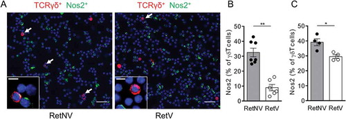 Figure 3. Vitiligo-associated decrease of the proportion of NOS2 positive γδ T cells in primary melanoma and TdLNs.(A) Representative microscopy images showing γδ T cells positive for NOS2 from cells derived from TdLNs of RetNV or RetV mice and stained with antibodies to TCR γδ (red), NOS2 (green) and counterstained with DAPI (blue). Arrows indicate NOS2 expressing γδ T cells. Bars 10 µM. 40 X objective. (B, C) Quantification of NOS2 positive γδ T cells in TdLN (B) from RetNV (n = 7) and RetV (n = 6) and in primary melanoma (C) from RetNV and RetV (n = 4 each). It was performed from 500 to 1500 γδ T cells. Each point represents individual mouse. Bars are mean ± SEM. *P < 0.05, **P < 0.01 (Mann-Whitney test).