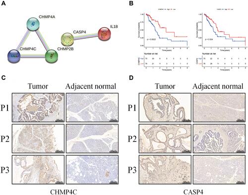 Figure 7 Expressions of CASP4 and CHMP4C in tumor and adjacent normal tissues. (A) The PPI network among the five pyroptosis-associated genes of the risk model (interaction score=0.4). (B) Kaplan–Meier OS analysis of PAAD patients based on the expression of CASP4 and CHMP4C. (C) The expressions of CHMP4C in tumor and adjacent normal tissues. (D) The expressions of CASP4 in tumor and adjacent normal tissues.