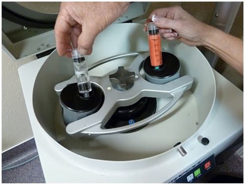 Figure 13 The SmartPRep®2 APC+™centrifuge, which forms part of the AdiPRep™ Adipose Transfer System (Harvest-Terumo, Plymouth, MA, USA).