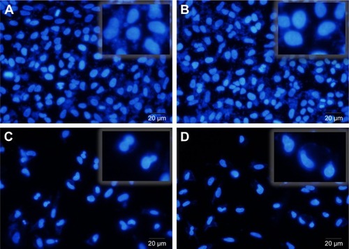 Figure 18 Fluorescent microscopic images of DAPI-stained cells following 48-hour treatment with fresh culture medium as a control (A), blank nanocarrier (B), free DOX-MTX (C), and DOX-MTX/nanocarrier (D).Abbreviation: DOX-MTX/nanocarrier, DOX-MTX-loaded magnetic nanocarrier.