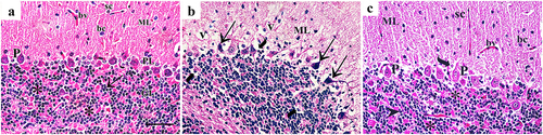 Figure 2. H&E-stained sections of rat cerebellar cortex showing: (a) the control groupshows cerebellar cortex formed of three layers; the molecular layer (ML) shows small, scattered stellate (sc), larger basket cells (bc) and blood vessels (bv). Purkinje cell layer (PL) is formed of pyriform-shaped Purkinje cells (p) with vesicular nuclei, prominent nucleoli, and basophilic cytoplasm. The granular layer (GL) shows tightly packed small, rounded granule cells (arrow) with deeply stained nuclei. Among these cells, cerebellar islands, or glomerulus (asterisks) are located. (b) In group II, the molecular layer (ML) shows cells with small dark nuclei, and vacuolated neuropil (v). Purkinje cells are shrunken, irregular shaped and deeply stained (arrow). Pericellular halos (curved arrows) are observed around Purkinje cells and granule cells. (c) Group III shows normal shaped molecular layer (ML) containing stellate cells (Sc), basket cells (bc) and blood vessels (bv). Some cells show pericellular halo (curved arrow). Purkinje cells (P) are pyriform in shape. They had vesicular nuclei with prominent nucleoli and basophilic cytoplasm. Granule cells (arrowhead) are tightly packed with darkly stained nuclei. Cerebellar islands or glomerulus (asterisks) are located among granule cells (H&E × 400; Scale bar = 30 µm).