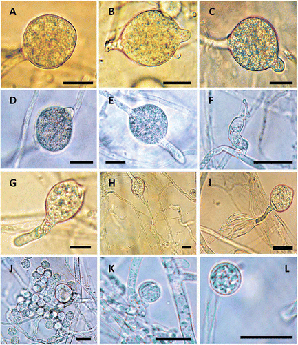 Fig. 4. Sporangia and zoospores of Pythium litorale. (A) sporangium without papilla; (B–D) sporangia with papillae; (E and G) sporangia with papillae emerging to discharge tubes; (F) discharge tube with undifferentiated protoplasm inside; (H and I) development of new sporangia by internal proliferation; (J) group of newly encysted zoospores; (K–L) a single encysted zoospore. Bar = 20 μm.