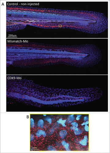 Figure 6. Immunostaining for CDK9 in whole larvae. (A) Confocal images of zebrafish embryo (Wik, wild type) 72 hpf control non-injected (above), injected with mismatch morpholino (middle) or CDK9-targeted morpholino (low) and immunostained with anti-CDK9 antibody, in red, and counterstained with DAPI. The staining shows diffuse presence of CDK9, in both nucleus and cytoplasm. The small yellow boxed area in a control non injected larva is shown at higher magnification in (B).