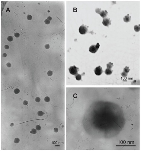 Figure 3 Transmission electron microscopic images of Lipofectamine-green fluorescence protein plasmid (A), mannosylated polyethylene glycol-phosphatidylethanolamine- Lipofectamine-green fluorescence protein plasmid (B and C).