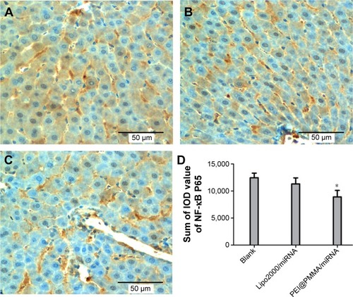 Figure 8 IHC analysis (A–C: microscope images, 400×) of NF-κB P65 expression in the liver tissues of mice after different treatments.Notes: (A) Blank group; (B) Lipo2000/miRNA; (C) PEI@PMMA/miRNA; (D) quantitative analysis. *P<0.05 is considered significant.Abbreviations: IHC, immunohistochemical; IOD, integral optical density; Lipo2000, Lipofectamine 2000; NF-κB, nuclear factor κB; PEI, polyethyleneimine; PMMA, poly(methyl methacrylate).