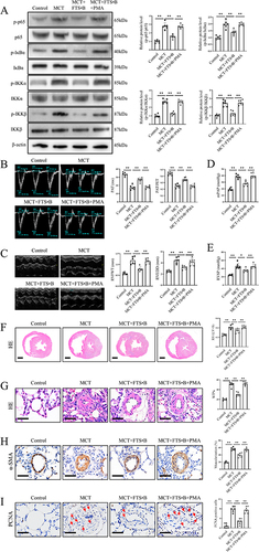 Figure 5 NF-κB activation blocked the protective effect of FTS•B against PAH and vascular remodeling. Rats were subjected to MCT and FTS•B with/without cotreatment with PMA. (A) Representative Western blotting of p-p65, p65, p-IκBα, IκBα, p-IKKα, IKKα, p-IKKβ and IKKβ in lung lysates, and quantitative data of p-p65/p65, p-IκBα/IκBα, p-IKKα/IKKα and p-IKKβ/IKKβ (n = 6). (B) Echocardiographic PW Doppler tracing of pulmonary artery outflow and quantitative analysis of PAT and PAT/PET (n = 6). (C) RVFWT and RVEDD in M-mode echo and relative quantification (n = 6). (D) Quantitative analysis of the mPAP (n = 6). (E) Quantitative analysis of the RVSP (n = 6). (F) Representative images of H&E staining of heart sections (scale bar = 2 mm) and quantitative analysis of the RV/ (LV + S) (n = 6). (G). Representative images of H&E staining of lung sections (scale bar = 50 μm) and quantitative analysis of the WT (n = 6). (H) Representative images of α-SMA immunohistochemical staining in the pulmonary artery (scale bar = 50 μm) and quantitative assessments of muscularized pulmonary arteries (n = 6). (I) Representative images of PCNA immunohistochemical staining in the pulmonary artery (scale bar = 50 μm) and quantitative data of PCNA-positive cells (n = 6). The data are presented as the mean ± SD. *p < 0.05, **p < 0.01.