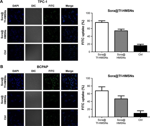 Figure 3 (A, B) CLSM images of FITC-labeled sora@HMSNs and sora@Tf-HMSNs uptaken by res-TPC-1 and res-BCPAP cells incubated for 24 hours.Notes: The HMSNs and nuclei were stained with FITC (green) and DAPI (blue), respectively. All experiments were performed in triplicate.Abbreviations: CLSM, confocal laser scanning microscope; Ctrl, control; FITC, fluorescein isothiocyanate; HMSNs, hollow mesoporous silica nanoparticles; sora@HMSNs, HMSNs loaded with sorafenib; sora@Tf-HMSNs, transferrin-conjugated HMSNs loaded with sorafenib.