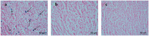 Figure 3. Prussian blue staining results of the tumor tissues in the groups intervened with FA-MAN (a), MAN (b) and FA-MAN + FA (c) at 72 h post-injection (×400 magnification) (the arrows show the Prussian blue-stained iron nanoparticles).