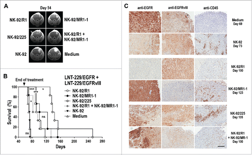 Figure 5. Antitumor activity of CAR NK cells against mixed LNT-229/EGFR and LNT-229/EGFRvIII GBM xenografts. (A) LNT-229/EGFR and LNT-229/EGFRvIII cells were mixed at a 1:1 ratio before stereotactic injection of the cells into the right striatum of NSG mice. Seven days later, the animals were treated by intratumoral injection of parental NK-92, EGFR-specific NK-92/R1, EGFRvIII-specific NK-92/MR1-1, dual-specific NK-92/225, or a 1:1 mixture of NK-92/R1 and NK-92/MR1-1 cells once per week for 8 weeks (n = 6). Control mice received injection medium. Tumor development in representative animals from each group at day 54 is shown. (B) Symptom-free survival of the mice from the experiment described in (A). ***p ≤ 0.001; *p ≤ 0.05; ns, p > 0.05. (C) Sections of tumors from individual animals of each treatment group sacrificed at the indicated time point were stained with EGFR- or EGFRvIII-specific antibodies. NK cells present in tumor tissues were detected with CD45-specific antibody. Scale bar: 300 µm.