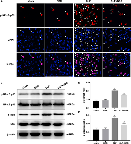 Figure 3 Berberine (BBR) inhibited the NF-κB signaling pathway in the lungs of cecal ligation and puncture (CLP)-treated mice. (A) After euthanasia, lung tissue single-cell suspensions were collected for immunofluorescence staining to detect NF-κB p65 phosphorylation (n = 6 per group). (B) The levels of p-NF-κB p65, NF-κB p65, p-IκBα, and IκBα in the lung tissue total proteins were determined by Western blotting assays. (C and D) The values were calculated by densitometry, and the density was calculated relative to that of the corresponding total protein (*P < 0.05 vs sham and #P < 0.05 vs CLP; n = 3 per group).