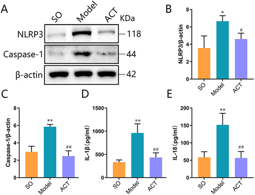 Figure 11 ACT attenuates renal pyroptosis levels. (A) Representative Western blot images displaying the detection of NLRP3 and Caspase-1. (B-C) Following treatment with ACT, levels of NLRP3 and Caspase-1 were both reduced. (D-E) ELISA analysis indicated that the expression levels of IL-1β and IL-18 both decreased following ACT treatment. Data are expressed as mean ± SD, n = 5. *P<0.05 and **P<0.01 vs sham-operated (SO) group; #P<0.05 and ##P<0.01 vs model (Model) group.