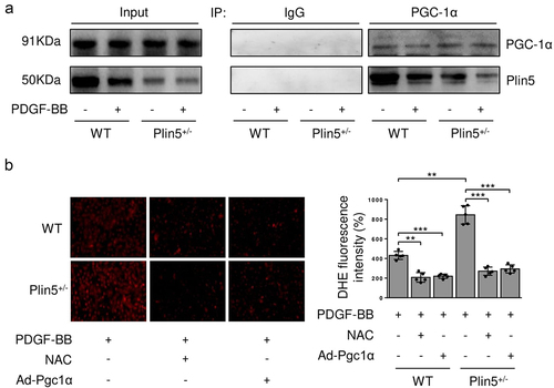 Figure 5. Declined plin5-PGC-1α interaction causes increased ROS level in VSMC. VSMC isolated from WT or Plin5± mice after 48 h of DMSO or PDGF-BB (30 ng/mL) treatment was subjected to immunoprecipitation (IP) using anti-PGC-1α antibody or control IgG. (a) Inputs and immunocomplexes were analyzed by immunoblotting. (b) VSMC isolated from WT or Plin5± mice was transfected with Ad-Con or Ad-Pgc1α. VSMC was next incubated with DMSO or NAC (10 nmol/L) for 8 h and PDGF-BB (30 ng/mL) for 48 h. Then, VSMC was stained with DHE (red). Representative images (left) and corresponding quantification of DHE fluorescence (right) were shown (n = 5). Magnification 400 × . **P < 0.01 and ***P < 0.001 denote statistical comparison between the two marked groups, respectively. Data are shown as mean ± S.D.