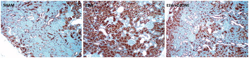 Figure 2. Immunohistochemical evaluation of kidney. (A) shows the sham-operated group. Immunostaining of the iNOS protein in the kidneys reveals intense positive staining (brown) in the tubular structure of kidneys subjected to SWT procedure (2B). Immunostaining for iNOS is lower in the SWT + OT group (2C) when compared with the SWT group.