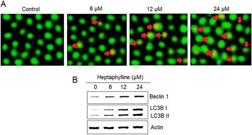 Figure 4. Heptaphylline induces autophagy in pancreatic cancer cells. (A) AO staining analysis of PANC1 pancreatic cancer cells administered with 0, 6, 12 or 18 µM heptaphylline (Arrows depict autophagic vesicles) (B) expression analysis of autophagy marker proteins from PANC1 pancreatic cancer cells administered with 0, 6, 12 or 18 µM heptaphylline. Experiments were performed independently in triplicates.