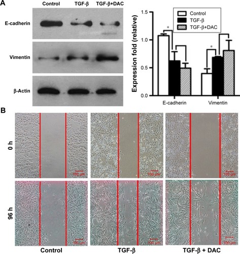 Figure 4 DAC treatment does not affect TGF-β1-induced EMT in A549 cells.