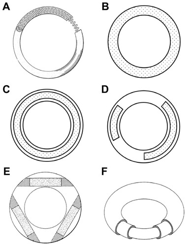 Figure 1 Representative vaginal ring designs. (A) Over-molded metal spring design first described in a 1970 patent.Citation4 (B) Matrix-type ring with solid micronized drug dispersed throughout the entire polymer. (C) Full length reservoir/core ring design, where the drug-loaded core is encapsulated by a nonmedicated, rate-controlling polymer membrane. (D) Multiple partial core ring design, where each core contains a different drug substance. (E) Insertable core ring design, where drug-loaded cores are inserted into a prefabricated ring body before sealing the ends. (F) Sandwich or shell ring design, where a drug-loaded layer is sandwiched between a nonmedicated polymeric central core and a nonmedicated outer rate-controlling polymer membrane.