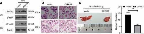 Figure 4. Overexpression of DIRAS3 significantly inhibits the metastasis of NSCLC cells in vivo. A. Western blot assay was utilized to test DIRAS3 protein expression in vector-A549 cell lines and DIRAS3-A549 cell lines. B. Two months after tail vein injection of DIRAS3-A549 cell line, the lung tissues were observed with HE staining. C. Representative images of lung metastatic nodules (arrows indicate metastatic nodules) fixed by 10% formalin buffer and counts of lung metastatic nodules two months after the injection of vector-A549 and DIRAS3-A549 stable cell lines. n = 6. ***P < 0.001. The data were expressed as mean ± standard deviation. Student’s t was used for analysis.