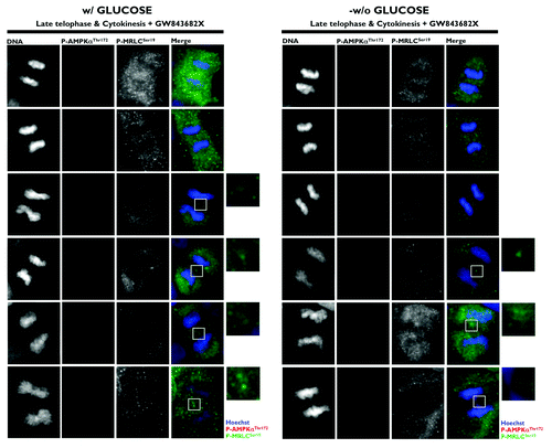 Figure 4. Spatio-temporal dynamics of phospho-AMPKαThr172 and phospho-MRLCSer19 during mitosis and cytokinesis: Impact of the PLK1 inhibitor GW843682X. Glucose-supplemented (left panels) and glucose-starved (right panels) A431 cells were treated with 10 μmol/L GW843682X for 30 min. Figure shows representative portions of cell dividing-containing images captured on a BD PathwayTM 855 Bioimager System with a 40x objective in different channels for phospho-AMPKThr172 (red), phospho-MRCLSer19 (green) and Hoechst 33258 (blue) and merged using BD AttovisionTM software. The rectangular regions (white line) are enlarged and shown as high magnification insets.