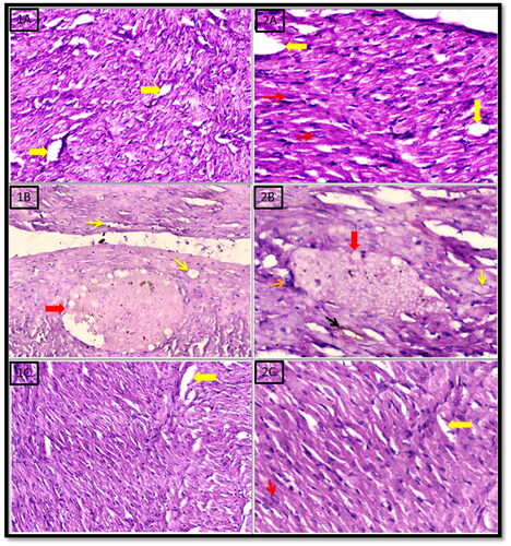 Figure 6. Histopathological examination of the heart in rats treated with control, celecoxib and the target compound 5d.