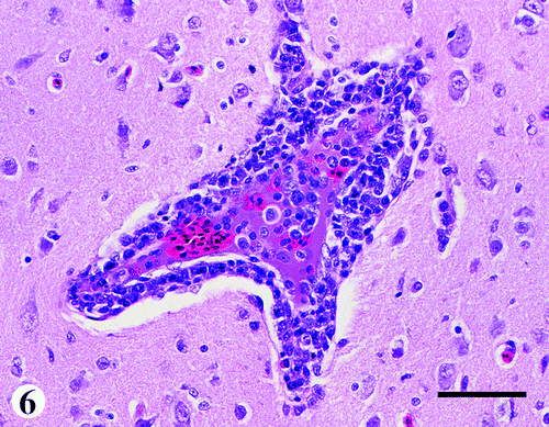 Figure 6. Brain from a 47-day-old broiler chicken infected with M. synoviae, in which there is infiltration of primarily lymphocytes in and around the blood vessel. Haematoxylin and eosin, bar=85 μm.
