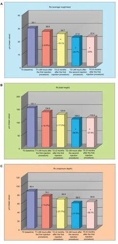 Figure 6 Skin profilometry of the area around the eyes reporting (A) average roughness Ra, (B) total height Rt and (C) maximum depth Rv at the different time points.