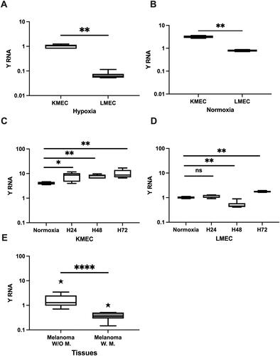 Figure 2. Relative expression of Y RNA in hypoxic and normoxic KMeC and LMeC cells and COM tissues by qRT-PCR. A. Relative expression in hypoxic KMeC and LMeC cells. B. Relative expression in normoxic KMeC and LMeC cells. C,D. Relative expression of Y RNA after different durations (24, 48, 72 h) in hypoxic KMeC cells versus normoxic cells. E. Relative expression level of Y RNA in non-metastatic melanoma (n = 17) and metastatic melanoma (n = 8) tissue samples. The Y axis indicates relative noncoding RNA expression levels in log10 units. KMeC and LMeC; replicate number = 6. Data were analyzed with one-way ANOVA (nonparametric) followed by the Kruskal–Wallis and Mann–Whitney U tests. Differences were considered significant when the p value was <0.05 (*p < 0.05, **p < 0.01, ****p < 0.0001). H: hypoxia; COM: canine oral melanoma; W/O: non-metastatic melanoma; W: metastatic melanoma, ns: not significant.