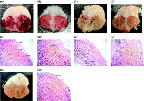 Figure 3. Histological evaluation of antiulcer activity of MEMC against ethanol-induced gastric lesions in rats. (A) Stomach of a negative control rat; (B) stomach of a rat pretreated with 100 mg/kg ranitidine; (C) stomach of a rat pretreated with 100 mg/kg MEMC; (D) stomach of a rat pretreated with 250 mg/kg MEMC; (E) stomach of a rat pretreated with 500 mg/kg MEMC. Respective histopathological sections are shown together; (Ai) stomach of the control animal showing a severe effect on mucosa with hemorrhagic erosion, edema, necrosis and erosion; (Bi) stomach of 100 mg/kg ranitidine-treated animals showing moderate hemorrhage and edema; (Ci) stomach of 100 mg/kg MEMC-treated animals showing almost normal mucosa with mild edema; (Di) stomach of 250 mg/kg MEMC-treated animals showing almost normal mucosa with mild edema; (Ei) stomach of 500 mg/kg MEMC-treated animals show almost normal mucosa. H, hemorrhage; ED, edema; ER, erosion; N, normal architecture.
