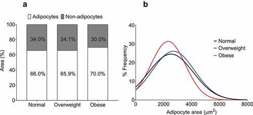 Figure 3. Quantification of non-adipocyte area and epicardial adipocyte size frequency distribution in normal, overweight, and obese groups. (a) Non-adipocyte area is presented as a percentage relative to adipocyte area. No difference was found between the groups as assessed by one-way ANOVA (p = 0.55). (b) Curves fitted from the adipocyte size frequency distributions from normal (886 cells from 8 patients), overweight (1739 cells from 28 patients), and obese (1247 cells from 13 patients) BMI groups. The distribution from the obese group is relatively leftward and upward of the normal and overweight groups, indicating a higher proportion of smaller adipocytes.