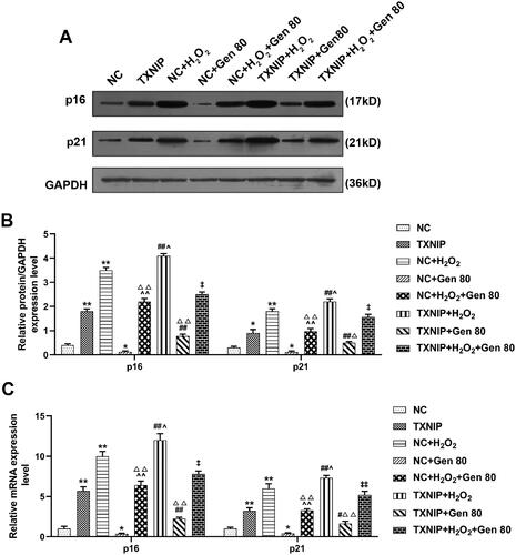 Figure 7. Overexpressed TXNIP partially reversed the effect of Gen on the expression of senescence genes in H2O2-treated HUVECs. HUVECs were transfected with overexpressed TXNIP plasmid, treated with H2O2 or Gen alone or combination. (A, B) After transfection of overexpressed TXNIP plasmid, the relative protein expression of p16 and p21 in H2O2-treated HUVECs under 80 μg/mL Gen treatment were measured by western blot. GAPDH was used as the internal control. (C) After transfection of overexpressed TXNIP plasmid, the relative mRNA expression of p16 and p21 in H2O2-treated HUVECs under 80 μg/mL Gen treatment were determined by qRT-PCR. GAPDH was used as the internal control. All experiments were performed in triplicate and the experimental data were expressed as mean ± standard deviation (SD) (*p< 0.05, **p< 0.01, vs. NC; ∧p< 0.05, ∧∧p< 0.01, vs. NC + H2O2; #p< 0.05, ##p< 0.01, vs. TXNIP; ‡p< 0.05, ‡‡p< 0.01, vs. NC + H2O2+Gen80; Δp< 0.05, ΔΔp< 0.01, vs. NC + Gen80). HUVECs: human umbilical vein endothelial cells; TXNIP: thioredoxin-interacting protein; NC: negative control.