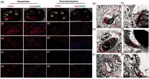 Figure 4. Disruption of TJs led to BBB breakdown, together with an increased bio-distribution of Ap-CSSA in vivo. (A) Confocal x–y–z scanning images of normal brain tissue section (A1–A4) and GBM-bearing brain (A5–A8), immune-stained for claudin-5 (red) and nuclear (blue) (Scale bar =50 μm). Ultrastructure of TJs in normal brain tissues (B, C), brain tumor (D, E) and the margin tissues of brain tumor (F, G) by TEM.