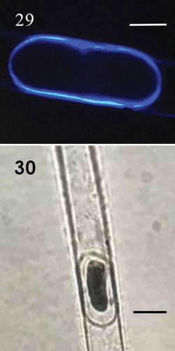 Fig. 29-30. Fig. 29 Aplanospore strain with calcofluor (CM); Fig. 30. Aplanospore (LM); Fig 29. Scale bar = 10 μm. Fig. 30. Scale bar = 20 μm