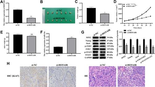 Figure 6 Knocking down HOTAIR inhibited tumorigenicity of CFPAC-1 cells.