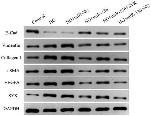 Figure 12. The protein expression of SYK, E-Cad, vimentin, collagen I, α-SMA, and VEGFA in cells of each group. WB was performed to measure the protein level of SYK, E-Cad, Vimentin, Collagen I, α-SMA, and VEGFA.