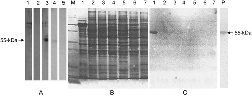 Figure 7. Detection of human brain β-tubulin and the specificity of the generated antibodies. A: total human brain protein was utilised in immunoblot assays with various anti-tubulin Abs including the pAb and mAbs generated throughout this study: 1, commercial mAb to β-tubulin type III; 2, commercial pAb to β-tubulin; 3, pAb to fusion protein (10−1 dilution); 4, mAb (#50) to repeated peptide; 5, mAb (#99) to repeated peptide. Note that pAb and mAbs generated reacted strongly to the 55-kDa human brain β-tubulin. B: total protein extracted from various animal brains (including human) was separated by SDS-PAGE and stained with Coomassie blue dye. C: corresponding immunoblot of gel from Panel B plus positive human β-tubulin control probed with mAb (#50): Lane M, protein molecule weight marker; Lane 1, total protein from human brain; Lane 2, ox; Lane 3, pig; Lane 4, dog; Lane 5, cat; Lane 6, rat; Lane 7, chicken; P, positive human brain β-tubulin III. Note that the mAb specifically reacted to only human brain.