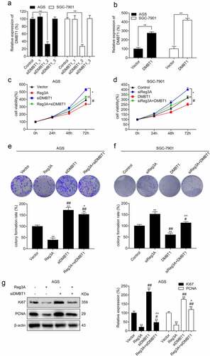 Figure 6. Reg3A regulated cell proliferation via DMBT1 in GC cells. DMBT1 was (a) knocked down and (b) overexpressed. Functions of Reg3A inhibiting cell viability (c) and clone formation (e) were reversed by DMBT1 siRNA. Functions of Reg3A siRNA promoting cell viability (d) and clone formation (f) were reversed by DMBT1. (g) Functions of Reg3A inhibiting Ki67 and PCNA expression were reversed by DMBT1 siRNA. *, P < 0.05 or **, P < 0.01 vs control or vector group; #, P < 0.05 or ##, P < 0.01 vs Reg3A or siReg3A group; ^, P < 0.05 or ^^, P < 0.01 vs siDMBT1 or DMBT1 group