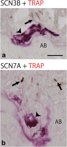 Figure 7. Microphotograph of sodium voltage-gated channel beta subunit 3 (SCN3B) (a), alpha subunit 7 (SCN7A) (b) and tartrate-resistant acid phosphatase (TRAP) staining in the compression area of the PDL after 5 days of tooth movement. SCN3B-immunoreactive nerve fibres (arrow in a) are very close to a TRAP-positive cell (arrowhead in a). However, SCN7A-IR nerve fibres (arrow) were distant from a TRAP-positive cell (arrowhead in a). Scale bar = 20 μm.