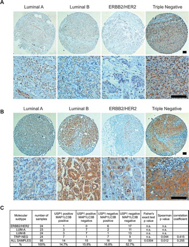 Figure 10. USP1 and LC3 proteins are expressed and significantly correlate in a subset of mammary tumors. (a and b) Representative images. Scale bars: 100 μm. (c) The table shows the number and percentage of USP1- and MAP1LC3B-positive samples for each group. Fisher’s exact test and Spearman’s test were performed in order to verify the correlation between USP1 and MAP1LC3B expression. P values and statistics are indicated for each group.