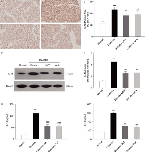 Figure 6 JMT decreased IL-1β and IL-18 expression in serum and SNs of diabetic rats.