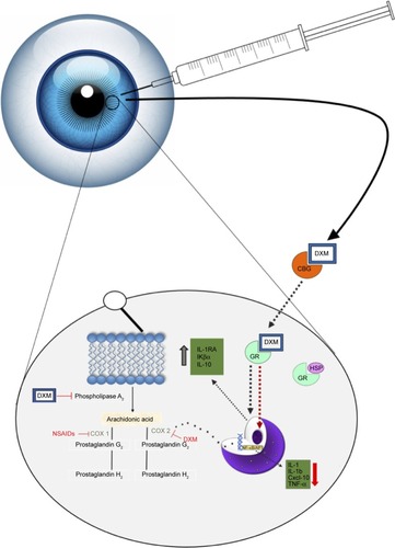 Figure 1 A model of the mechanism of action upon administration of intraocular DXM.