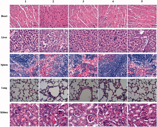 Figure 9. Histopathological analysis of main organs with H&E staining. (1) Physiological saline; (2) free daunorubicin; (3) daunorubicin liposomes; (4) daunorubicin plus dihydroartemisinin liposomes; (5) OCT-modified daunorubicin plus dihydroartemisinin liposomes. Images were obtained under 20× objectives.